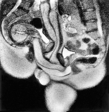 anatomy during sexual intercourse (raw image)